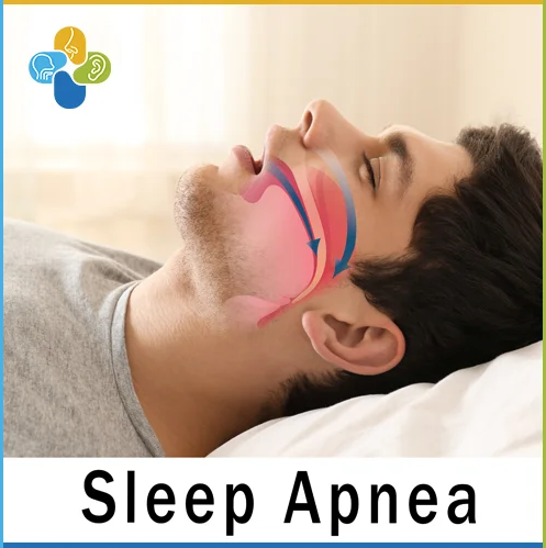 Αποφρακτική Υπνική Άπνοια