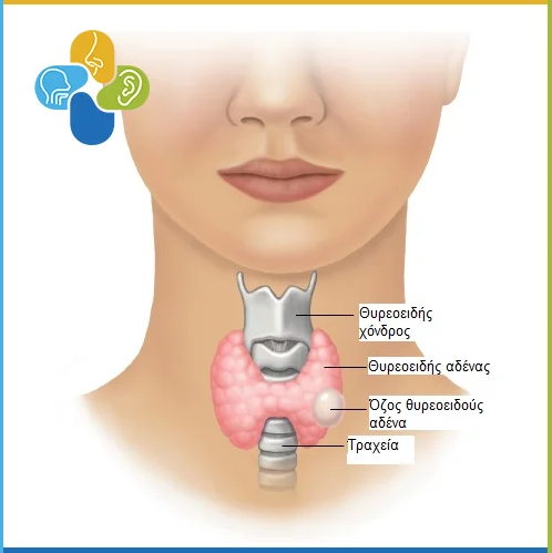 βρογχοκήλη