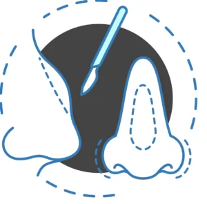 ρινοπλαστικη